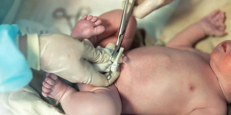 inguinal hernia in babies