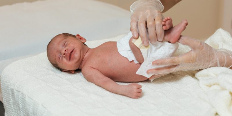 Newborn not passing stool what to do Bangalore